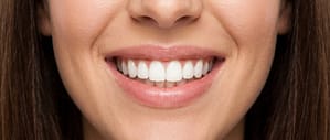 Odontología estética en Arrecife: Transformando sonrisas