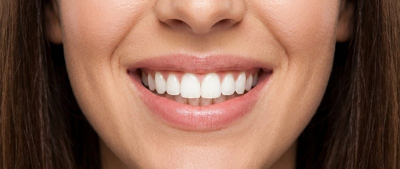 Odontología estética en Arrecife: Transformando sonrisas
